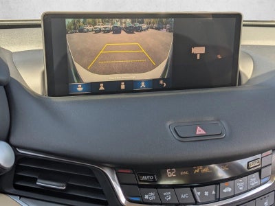 2025 Acura TLX FWD w/Technology Package