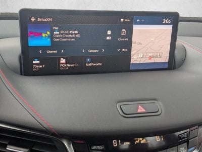 2025 Acura TLX SH-AWD w/A-Spec Package