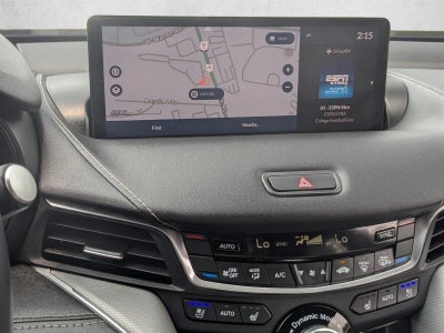 2025 Acura TLX SH-AWD w/A-Spec Package
